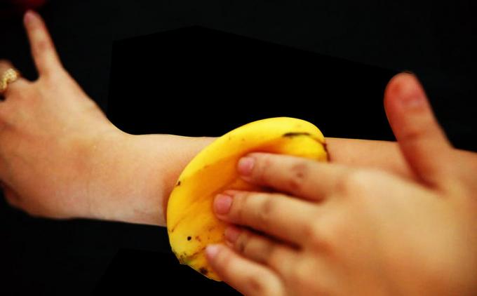 Banana kože dokonale zmierňuje svrbenie od bodnutí komárom